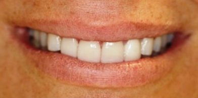 Midtown General & Cosmetic Dentistry after16