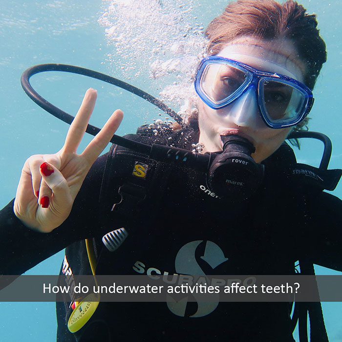 underwater teeth 2022 700 Midtown General & Cosmetic Dentistry