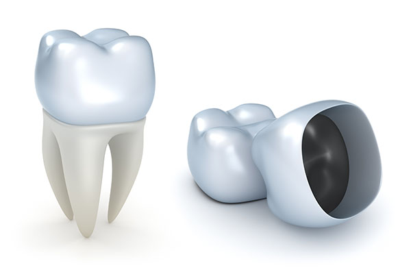 Maintenance Tips To Help Dental Crowns Last
