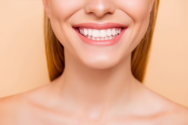 Are Veneers The Right Choice For Your Smile Goals?